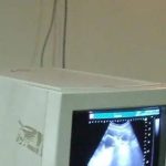 गर्भाचे लिंग शोधण्यात मदत करणाऱ्या ॲप्सवर बंदी घाला: सिव्हिल सर्जन राज्य सरकारला पत्र | पुणे बातम्या